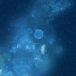 File:Cyclospora UV Henry1.jpg