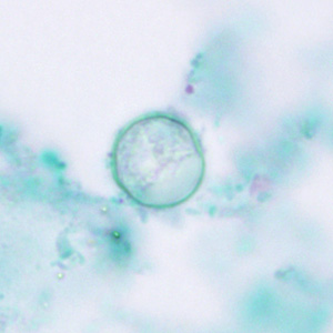 Oocysts of C. cayetanensis stained with trichrome; while the oocyst is visible, the staining characteristics are inadequate for a reliable diagnosis. Adapted from CDC