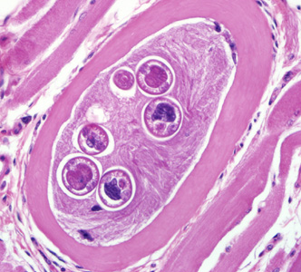 Encysted larvae of Trichinella sp. in muscle tissue, stained with hematoxylin and eosin (H&E). Image was captured at 400x magnification. Adapted from CDC