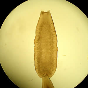 D. caninum proglottid under a dissecting microscope cleared with lactophenol. Adapted from CDC