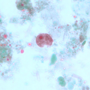 Trophozoite of I. buetschlii trophozoite stained with trichrome. Adapted from CDC
