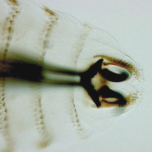 Close-up of the anterior end of the larva in Figure 1, showing the cephalopharyngeal skeleton and mandibles. Adapted from CDC