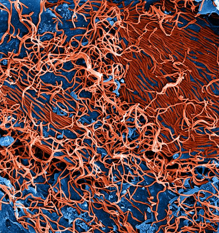 Produced by the National Institute of Allergy and Infectious Diseases (NIAID), under a very-high magnification, this digitally-colorized scanning electron micrograph (SEM) depicts a number of filamentous Ebola virus particles (red) that had budded from the surface of a VERO cell (blue-gray) of the African green monkey kidney epithelial cell line. From Public Health Image Library (PHIL). [4]