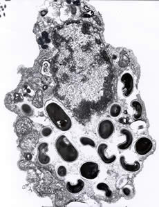 Electron micrograph of an eukaryotic cell with Encephalitozoon intestinalis spores and developing forms inside a septated parasitophorous vacuole. The vacuole is a characteristic feature of this microsporidian species. Adapted from CDC