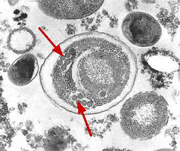Electron micrograph of an Enterocytozoon bieneusi spore. Arrows indicate the double rows of polar tubule coils in cross section which characterize a mature E. bieneusi spore. Adapted from CDC