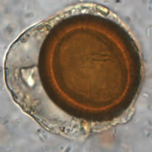 Iodine-stained wet mount of a Taenia sp. egg. Image courtesy of the Oregon State Public Health Laboratory. Adapted from CDC