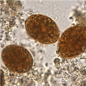Eggs of D. latum in an iodine-stained wet mount. Image courtesy of the Oregon State Public Health Laboratory. Adapted from CDC