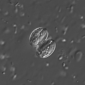 Sporulated oocyst of Sarcocystis sp. in a wet mount viewed under DIC microscopy, magnification 400x. Adapted from CDC