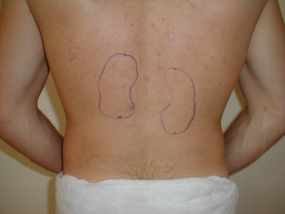 Posterior View: Location of the Kidneys