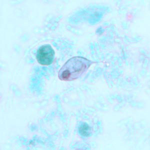 Trophozoite of C. mesnili from a stool specimen, stained with trichrome. Image taken at 1000x magnification. Adapted from CDC