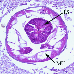 Cross-section of an adult of Oesophagostomum sp. in a colon biopsy specimen from a patient from Africa, stained with hematoxylin and eosin (H&E). Note the large, platymyarian muscle cells (MU) and thick, muscled esophagus (ES). Image taken at 200x magnification.