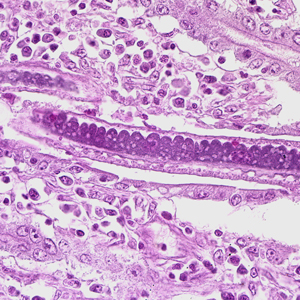 Higher magnification of Figure 3, showing stichocytes within the adult worm. Adapted from CDC