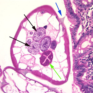 Cross-section of an adult female E. vermicularis from the same specimen shown in Figure 1. Note the presence of the alae (blue arrow), intestine (green arrow) and ovaries (black arrows). Adapted from CDC