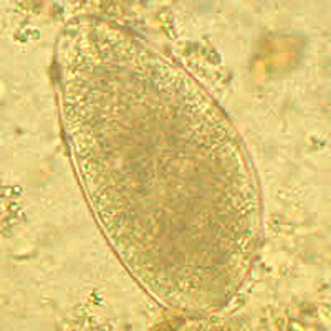 Egg of a trichostrongyle in an unstained wet mount of stool from a patient from Afghanistan. Eggs ranged in size from 87-92 µm in length by 50-55 µm in width. Images courtesy of the Leiden University Medical Center, The Netherlands. Adapted from CDC