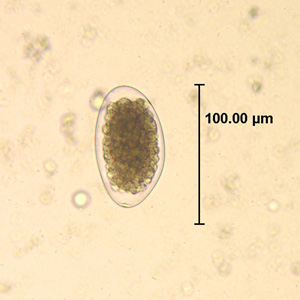 File:Trichostrongylus egg wtmt HB1.jpg