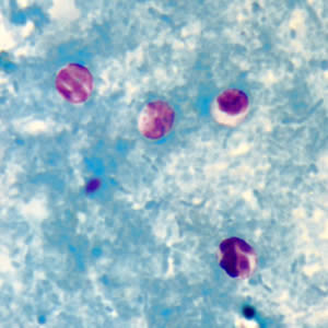 Cryptosporidium sp. oocysts stained with modified acid-fast. Adapted from CDC
