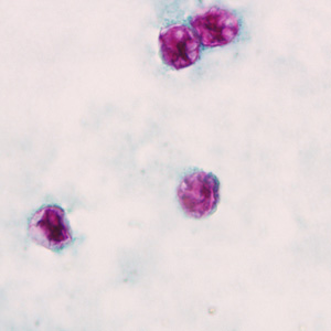 Oocysts of C. cayetanensis stained with modified acid-fast stain. Adapted from CDC