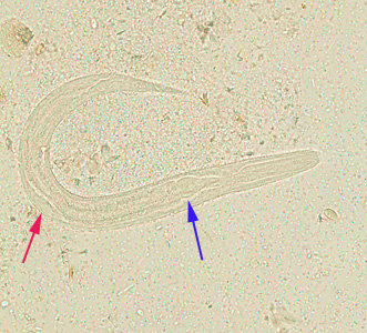 Rhabditiform larva of S. stercoralis in an unstained wet mount of stool. Notice the rhabditoid esophagus (blue arrow) and prominent genital primordium (red arrow). Adapted from CDC