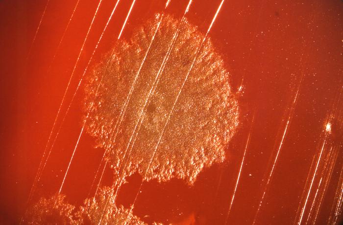 Photograph depicts a colony of Clostridium sp. Gram-positive bacteria, which had been grown on a 4% blood agar plate (BAP) over a 48 hour time period. From Public Health Image Library (PHIL). [1]