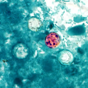 Oocysts of C. cayetanensis stained with modified acid-fast stain. Note the variability of staining in the four oocysts. Adapted from CDC
