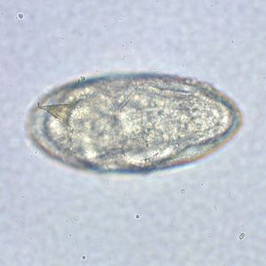 Egg of S. mansoni in an unstained wet mount. Images courtesy of the Missouri State Public Health Laboratory. Adapted from CDC