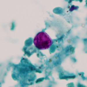 Oocyst of C. cayetanensis stained with modified acid-fast stain. Adapted from CDC