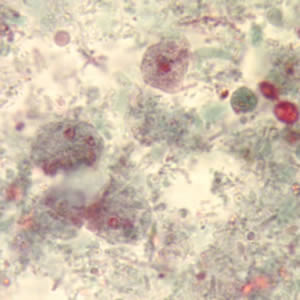 Binucleate and uninucleate forms of trophozoites of D. fragilis, stained with trichrome. Adapted from CDC