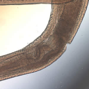 Mid-section of a Pseudoterranova sp. worm, showing the esophagus and intestine. Image taken at 40x magnification. Adapted from CDC