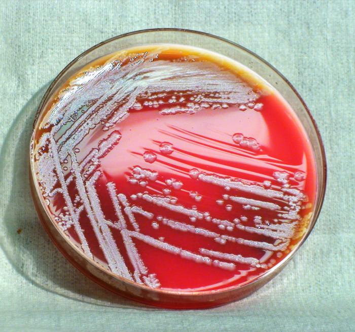 Gram-negative Burkholderia thailandensis bacteria, which was grown on a medium of SBA 48hrs. From Public Health Image Library (PHIL). [5]