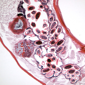 Longitudinal section of an adult female E. vermicularis from the same specimen as Figure 3. Note the presence of many eggs. Adapted from CDC