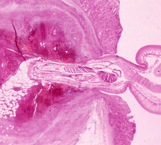 Cross-section of the intestine of a pig, stained with H&E, showing the anterior end of an adult Macracanthorhynchus hirudinaceous embedded within the intestinal wall. Adapted from CDC