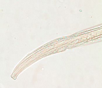 Posterior end of a male Trichostrongylus sp. Note the presence of a bursa (red arrow) and spicule (blue arrow). of a glycerin-mounted specimen, taken at 200x magnification. Adapted from CDC