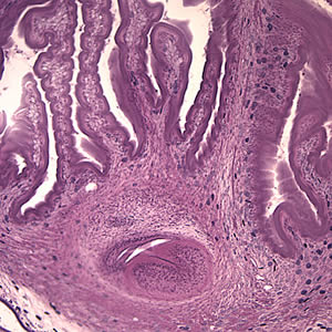 Higher magnification (100×) of the cyst in Figures 1 and 2. The parenchymatous portion of the cysticercus can be better observed. Adapted from CDC