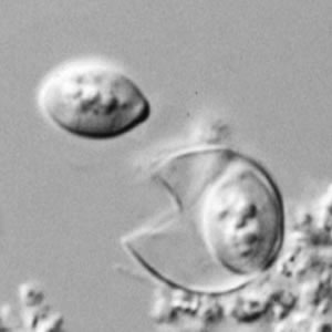 Rupturing oocyst of C. cayetanensis viewed under DIC microscopy. One sporocyst has has been released from the mature oocyst; the second sporocyst is still contained within the oocyst wall. Adapted from CDC