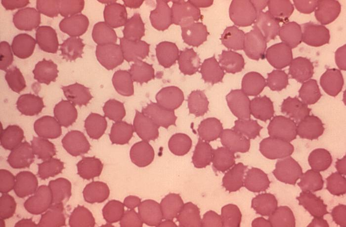 Micrograph of a blood smear containing Yersinia pestis plague bacteria.Adapted from Public Health Image Library (PHIL), Centers for Disease Control and Prevention.[15]