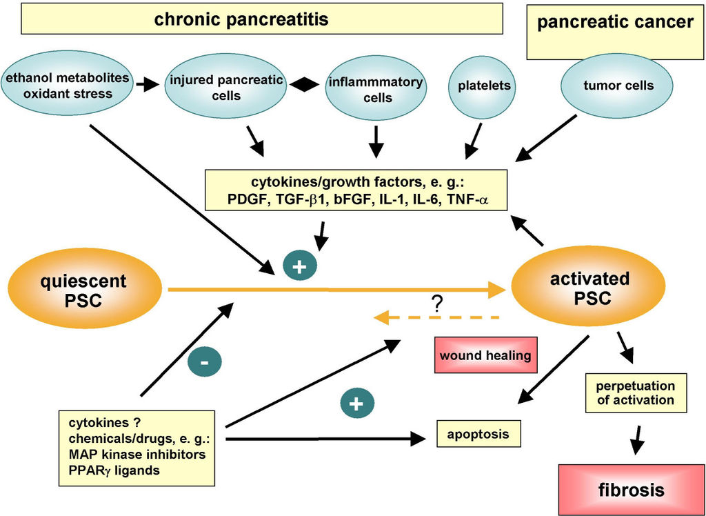 File:1024px-Pancreatic stellate cell activation in chronic pancreatitis and pancreatic cancer.jpg