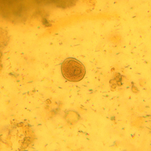 Cyst of C. mesnili in a concentrated wet mount of stool, stained with iodine. Image taken at 1000x magnification. Adapted from CDC