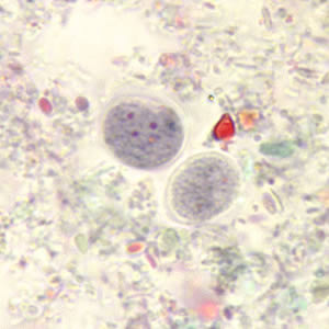 Cysts of E. nana stained with trichrome. Adapted from CDC