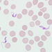 Trypanosoma brucei ssp. in a thin blood smear stained with Giemsa. Adapted from CDC