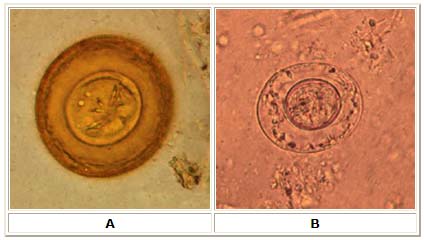 Egg of Hymenolepis diminuta (A), Egg of Hymenolepis (B)