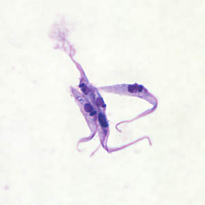 Trypanosoma cruzi epimastigotes from culture. Note the location of the kinetoplast anterior to the nucleus. Adapted from CDC