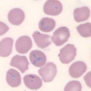 Babesia microti in a thin blood smear stained with Giemsa. Babesia sp. cannot be identified to the species level by morphology alone; additional testing, such as PCR, is always recommended. Adapted from CDC