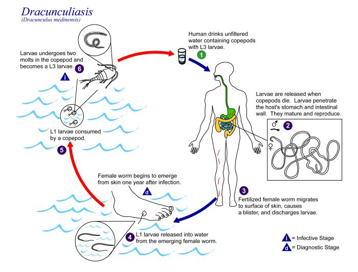 This is an illustration of the life cycle of Dracunculus medinensis, the causal agent of Dracunculiasis. From Public Health Image Library (PHIL). [8]