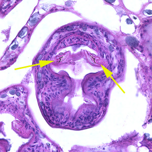 Higher magnification (400x) of the specimen in Figure 1. Notice a pair of refractile hooks (yellow arrows). Cestode hooks do not stain with H&E but may be visible with proper adjustment of the microscope. Adapted from CDC