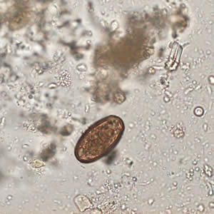 Egg of Dicrocoelium dendriticum in an unstained wet mount of stool. Image courtesy of Dr. Juan Cuadros González. Adapted from CDC