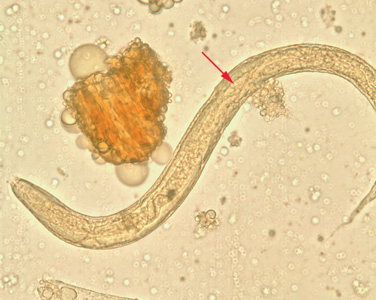 Rhabditiform larva of S. stercoralis in unstained wet mounts of stool. Notice the short buccal canal and the genital primordium (red arrows). Adapted from CDC