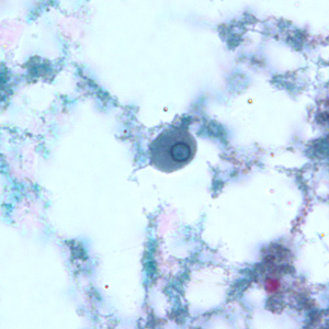 Trophozoite of E. gingivalis from culture, stained with trichrome. Adapted from CDC