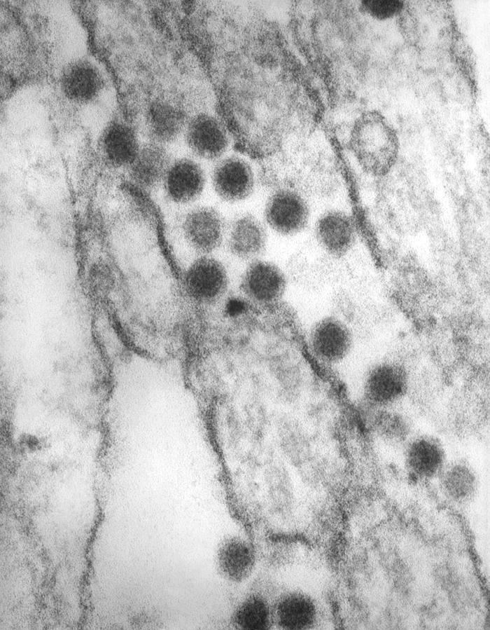 Transmission electron micrograph (TEM) reveals the presence of numerous St. Louis encephalitis virions that were contained within a tissue sample. From Public Health Image Library (PHIL). [4]