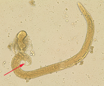 Free-living adult male S. stercoralis. Notice the presence of the spicule (red arrow). Adapted from CDC