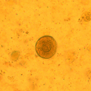 Cyst of C. mesnili in a concentrated wet mount of stool, stained with iodine. Image taken at 1000x magnification. Adapted from CDC